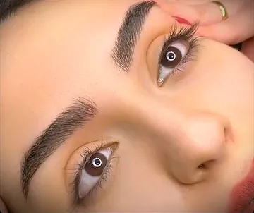 فیبروز ابرو
