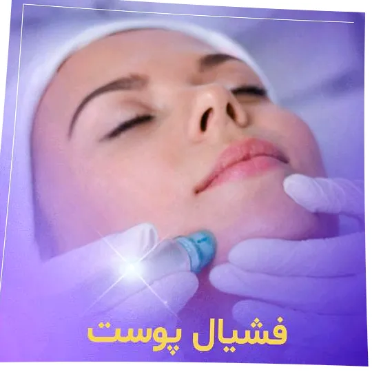 فشیال صورت